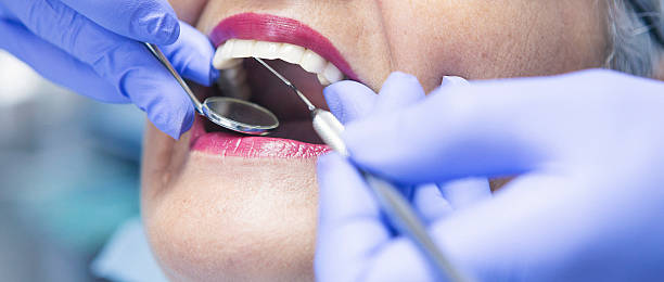 Best Emergency Root Canal Treatment in Glenmoor, OH